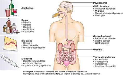 Vomiting - Definition, Causes of vomiting