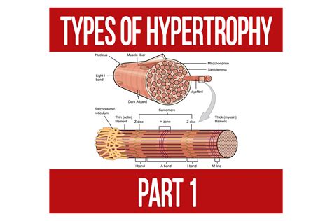 Types of Hypertrophy Part 1 - N1 Training