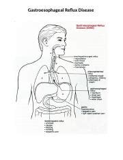 Bio Paper Final Docx Gastroesophageal Reflux Disease Gastroesophageal