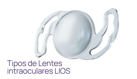 Tipos De Lentes Intraoculares Lios Ophtec University