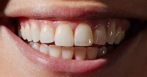 You Could Be Ruining Your Teeth With Common Morning Mistakes What To