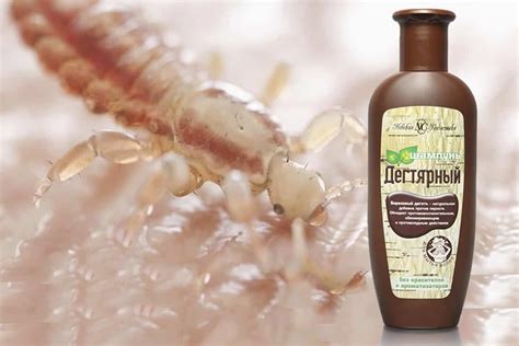 3 способа применения дегтярного мыла от вшей и гнид, лечит ли педикулёз?