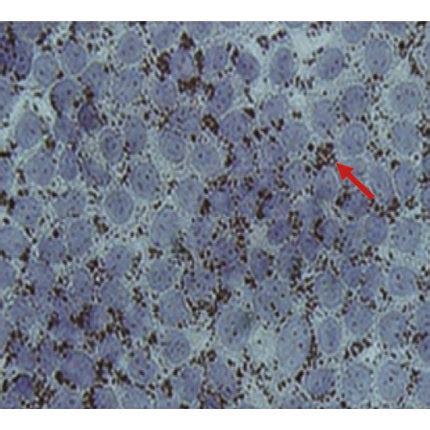 Lipid Accumulation In Fl B Cells By Oil Red O Staining A C Cells