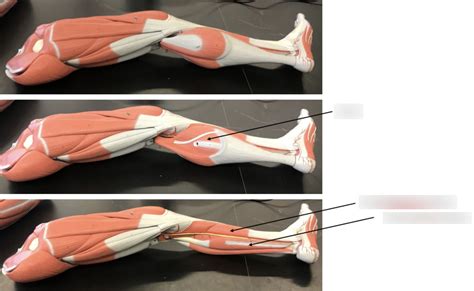 Muscles Lower Limb Part 2 REAL Diagram Quizlet