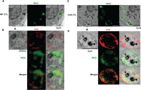 Analysis Of Lytic Granules In Control And Chs Patient Ctls By Clem