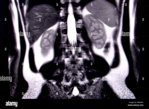 Viaje a través del abdomen y el tórax humano por medio de la resonancia