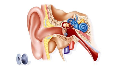 How to Procedure Ear Grommet - HealthBeauty123 | Your Health & Beauty Referrence