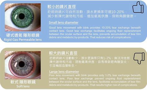 Specialty Contact Lenses Hong Kong Eye Hk Rgp Keratoconus Post