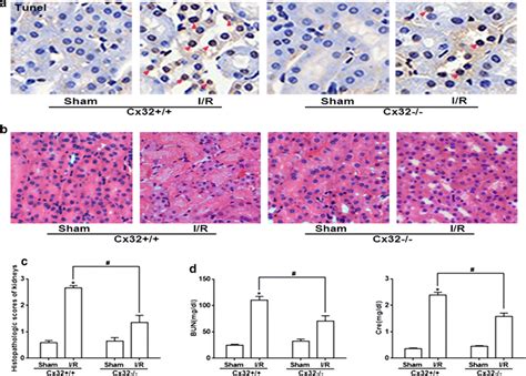 Cx Gene Deletion Markedly Attenuated I R Induced Renal Tubular