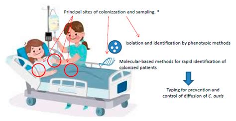 Antibiotics Free Full Text Candida Auris An Overview Of How To Screen Detect Test And