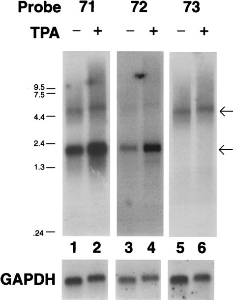 Analysis Of Lat Transcription Shown Is An Autoradiogram Of A Northern