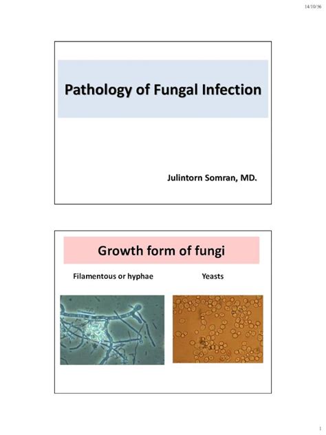 PDF Pathology Of Fungal PDF File14 10 56 3 Superficial Mycoses