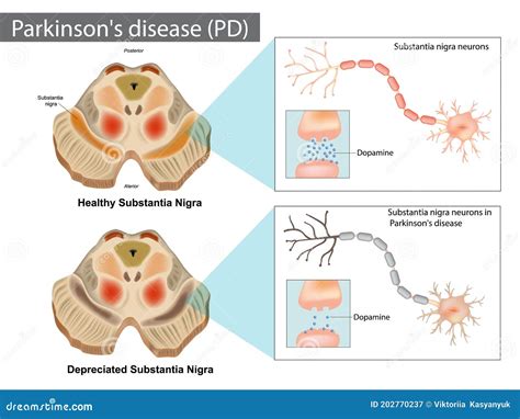 Substantia Nigra Of The Midbrain And Its Dopaminergic Neurons D