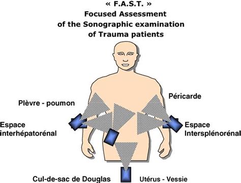 Échographie en traumatologie pour l urgentiste de l enseignement à la