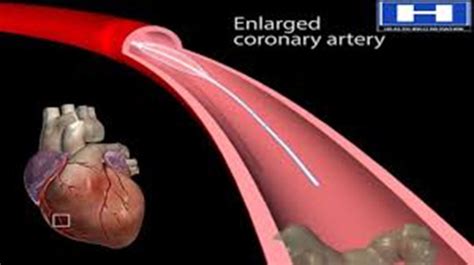 Ecg North Side Cardiology