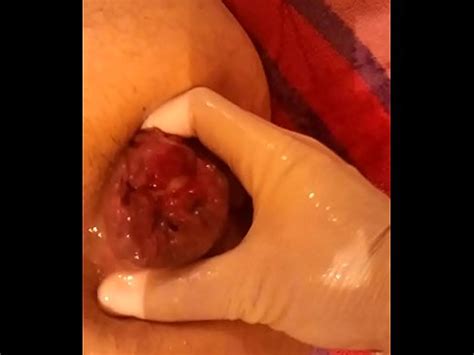 Fist Fuck Serbia XVIDEOS