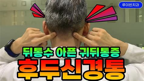 후두신경통 귀뒤통증 때문에 뒤통수가 찌릿찌릿 귀뒤쪽 뒷머리가 쑤실 때 머리두통 겪고 있다면 혈류장애 머리신경통 I