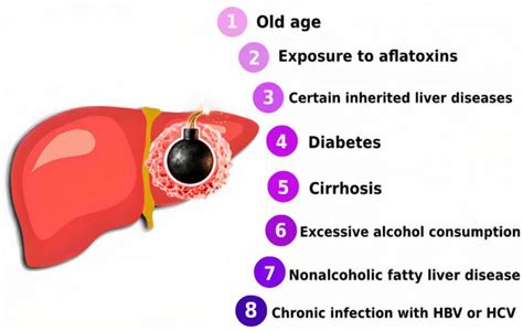 Liver Cancer Causes Symptoms Diagnosis And Treatment Options Page 8 Of 16 Healthella