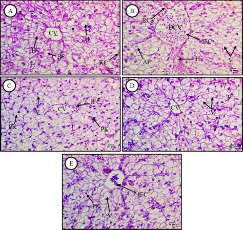 Hematoxylin And Eosin Hande Stained Liver Sections From Control And Download Scientific Diagram