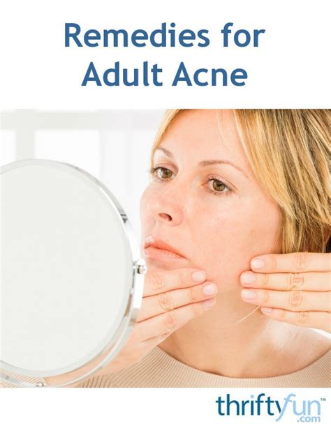 Remedies For Adult Acne Thriftyfun