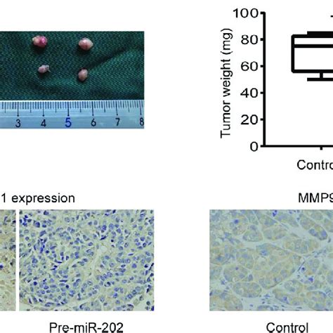 Tumor Formation In Nude Mice Revealed That MiR 202 Inhibited