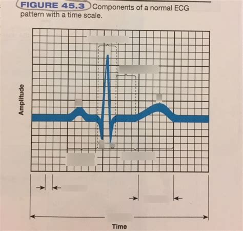 Figure 45 3 Ecg Pattern Diagram Quizlet