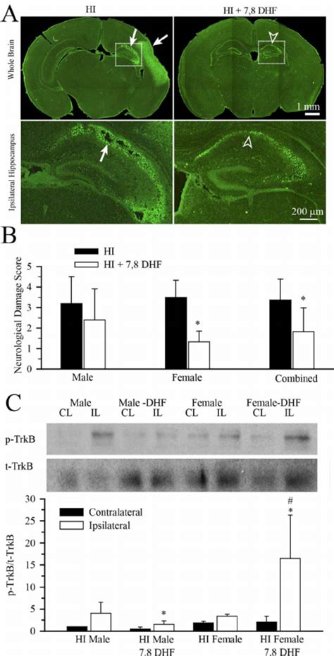 A B Evaluation Of Hippocampal Neuronal Damage After HI With FJ C