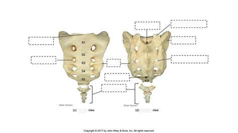 Lower Vertebra (Fused) Diagram | Quizlet