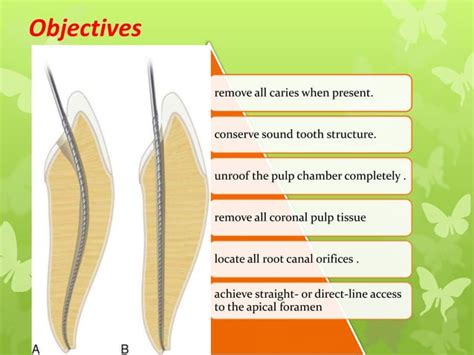 Acces Opening Of Anterior And Premolar Teeth Shadan PPT