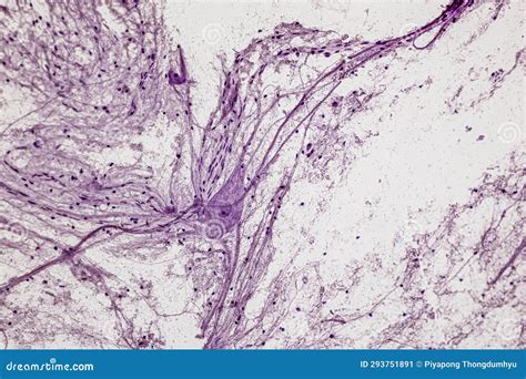 Motor Neuron, Spinal Cord, Nerve Fibres and Nerve Cells Under the ...