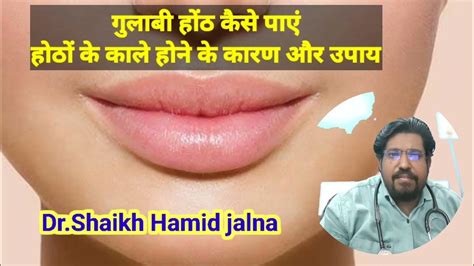 Dark Lips Causes And Treatment Lips Dehydration Smoking Healthy Thyroid Dr Original Youtube