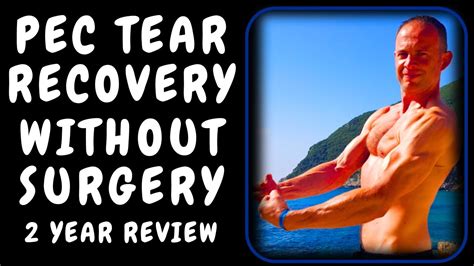 How I Recovered From A Pec Tear Without Surgery My Year Review