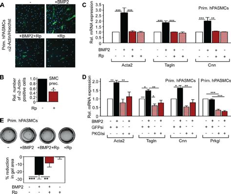 PKGI Is A Critical Mediator Of BMP Induced Contractile Gene Expression