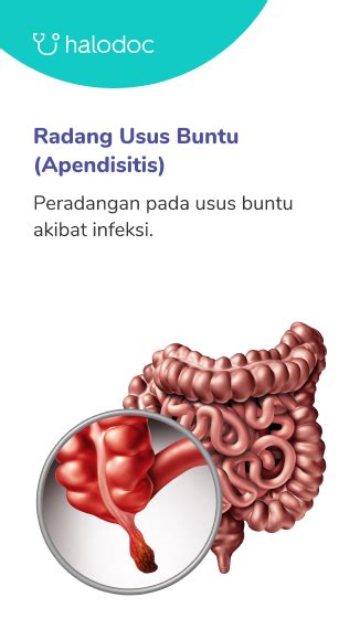 Cara Mengatasi Sakit Perut Sebelah Kanan Bawah