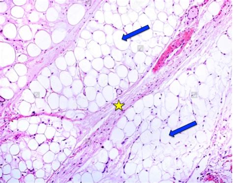 Adipose Tissue Diagram