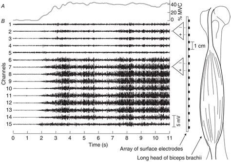 Extracting Information From High Density Surface Electromyogram A