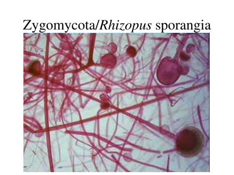 Ppt Chytridiomycota Allomyces Hyphae With Gametangia Powerpoint