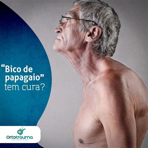 Bico De Papagaio Tem Cura Ortotrauma