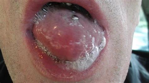 Tongue Gay Man Porn Xhamster