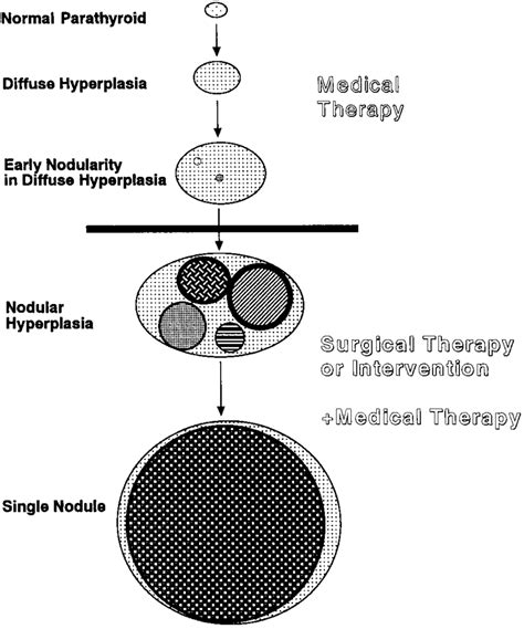 Progression Of Parathyroid Hyperplasia And Management Strategy Once