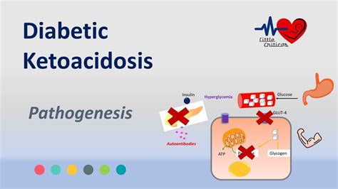 What Is Diabetic Ketoacidosis Pathogenesis And Diagnosis Of DKA