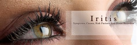 Iritis-Symptoms, Causes, Risk Factors and Home Remedies | Kayawell