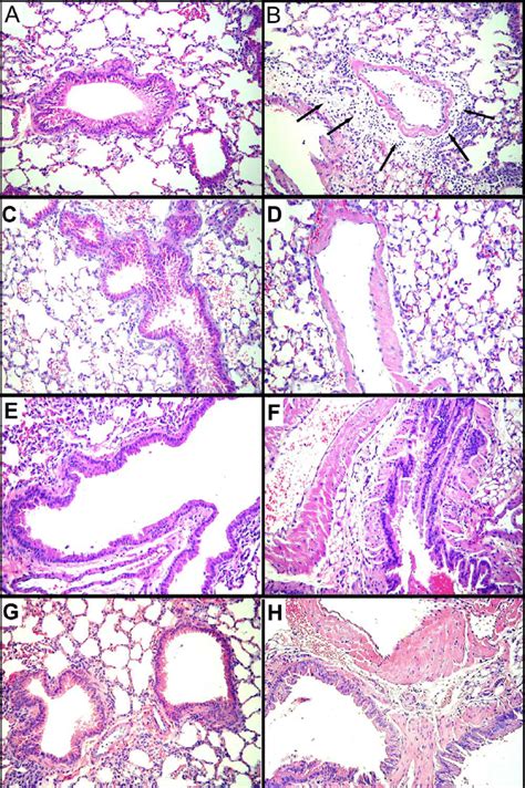 Sample Lung Histology From Balb C Mice Dosed With G Compacted Dna