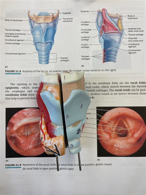 Trachea Anatomy Lab 7 Diagram Quizlet