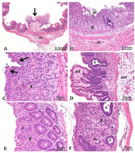 A Histopathological Data Of Experimental Enteritis Generated By TNBS