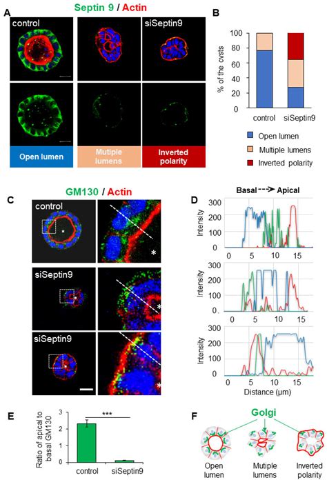 Cells Free Full Text Septin 9 Orients The Apicobasal Polarity Axis And Controls Plasticity