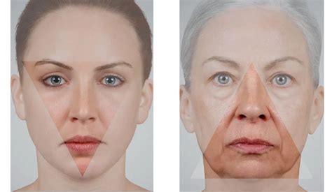 Understanding The Aging Face From The Triangle Of Youth To The Pyramid