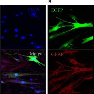 The Expression Of Nestin And Glial Fibrillary Acidic Protein GFAP