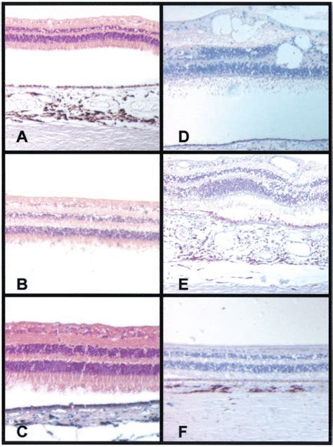 Pedf Protein Expression In Retinal Samples From Patients With Different