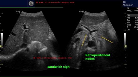 A Gallery of High-Resolution, Ultrasound, Color Doppler & 3D Images ...